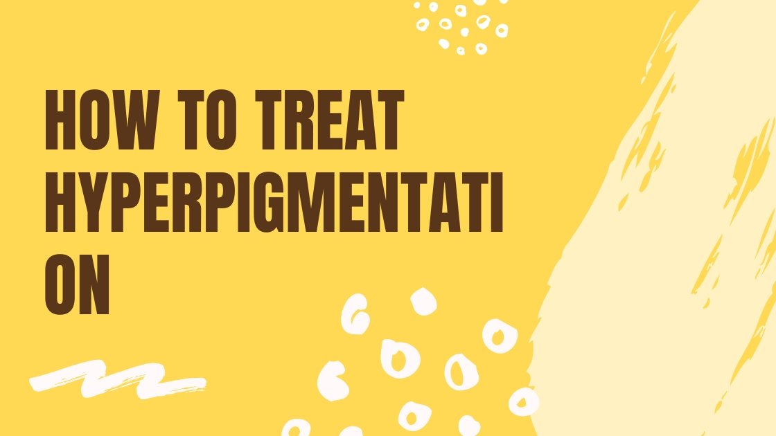 How to treat hyperpigmentation